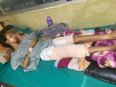 तीनकुने घटना : ८० दिनपछि अस्पतालबाट घर फर्किइन् रेबिका, अझै विश्राममै